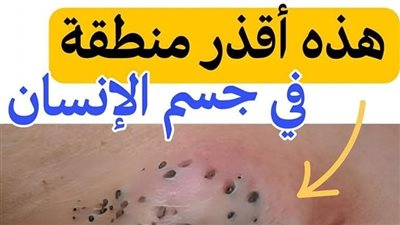 article
