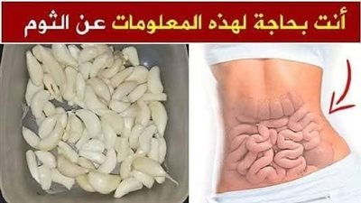 article